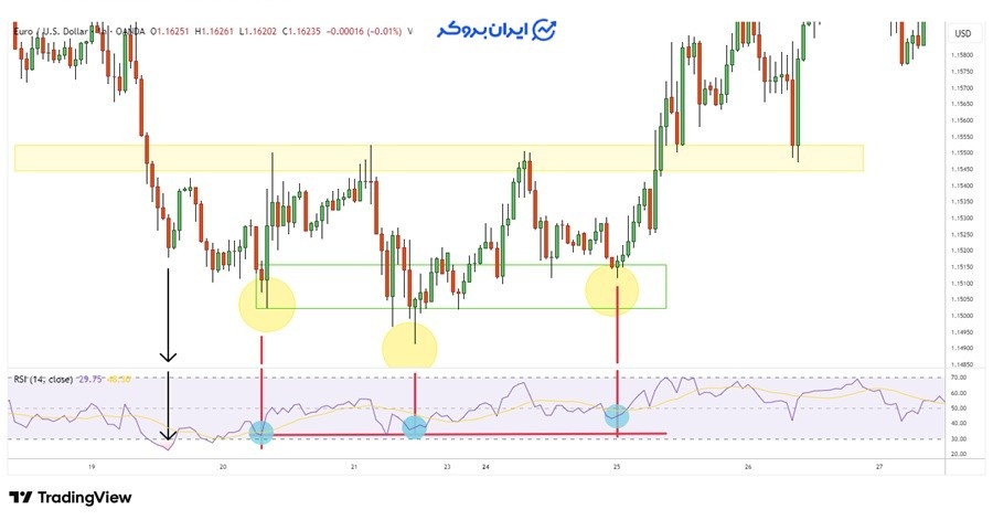 حجم در الگوی سر و شانه