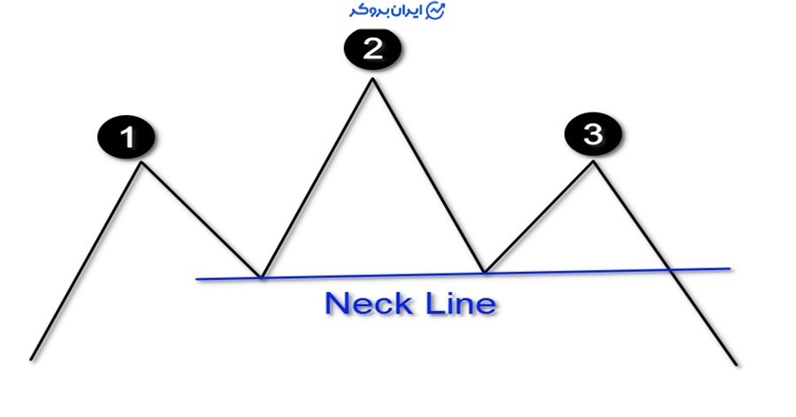 الگوی سر و شانه چیست؟