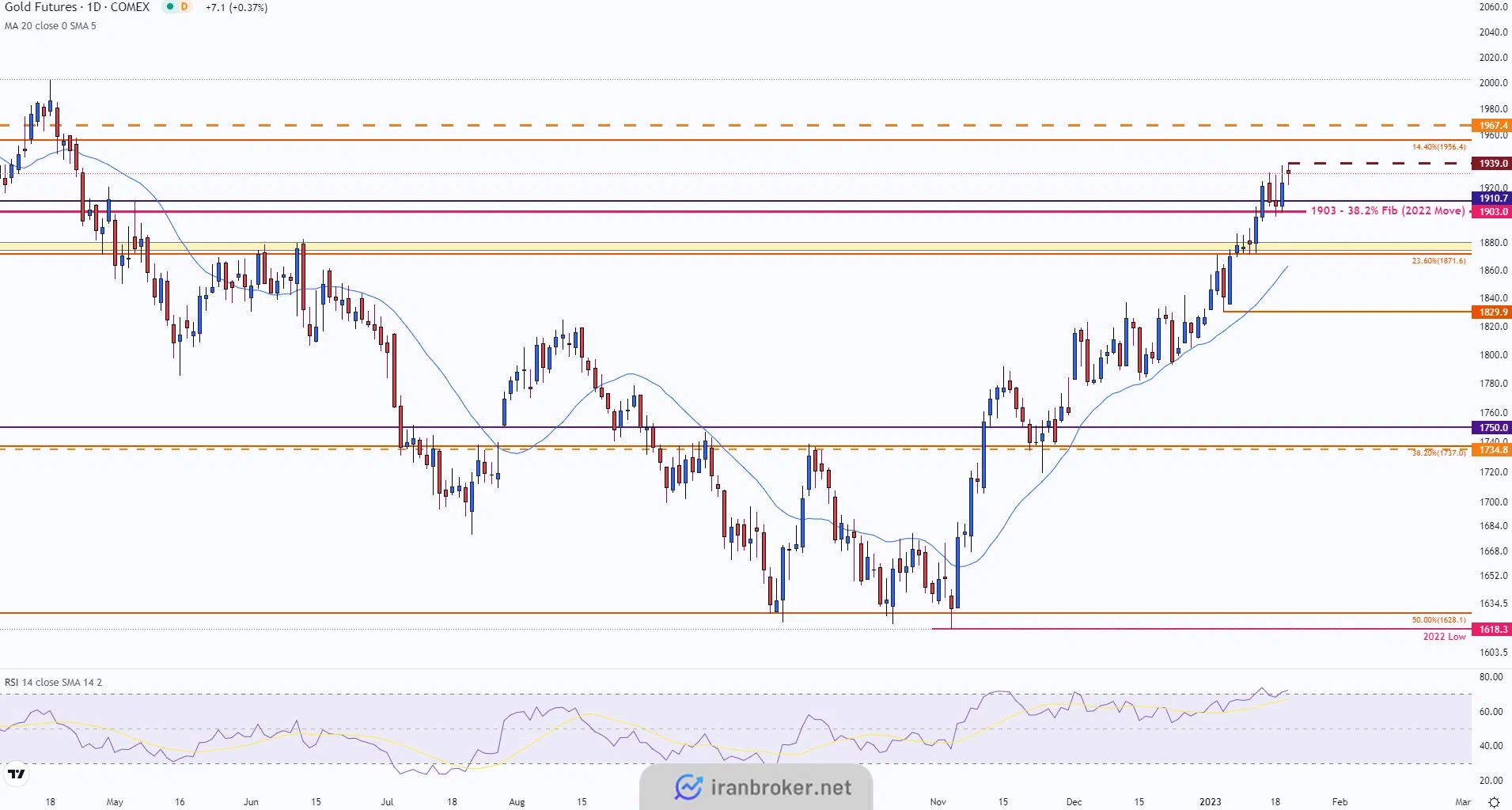 تحلیل چارت طلا در تایم فریم روزانه و در یکشنبه ۲ بهمن