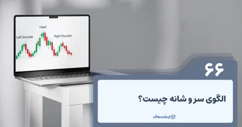 الگوی سر و شانه چیست؟