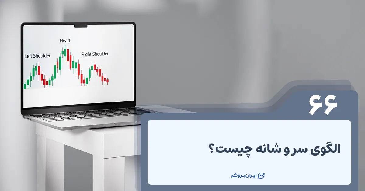 الگوی سر و شانه چیست؟